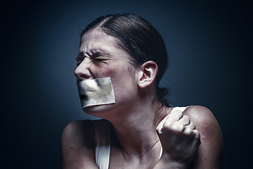 Image showing a young girl with a patch on her mouth