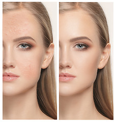 Image showing Woman before and after treatment