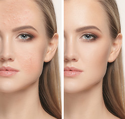 Image showing Woman before and after treatment