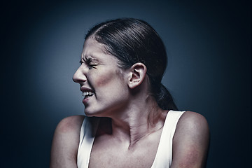 Image showing Close up portrait of a crying woman with bruised skin and black eyes