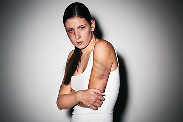 Image showing Close up portrait of a crying woman with bruised skin and black eyes