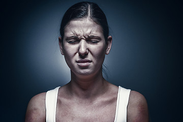 Image showing Close up portrait of a crying woman with bruised skin and black eyes