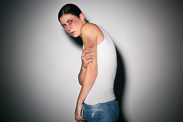 Image showing Close up portrait of a crying woman with bruised skin and black eyes