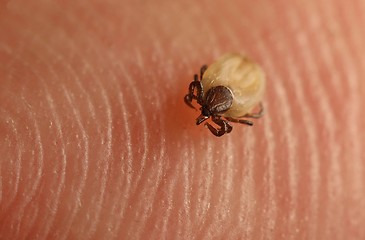 Image showing Tick on skin