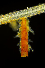 Image showing Microscopic view of unspecified eggs in tube shaped packet on Co