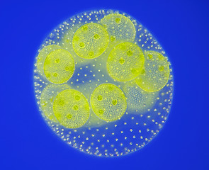 Image showing Spherical colony of freshwater green algae (Volvox)