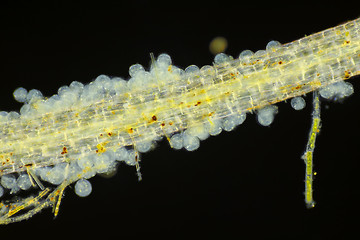 Image showing Microscopic view of unspecified eggs on Common duckweed (Lemna m