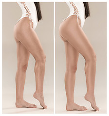 Image showing Woman\'s buttocks before and after plastic surgery