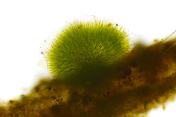 Image showing Spherical colony of cyanobacteria (Gleotrichia, blue-green algae