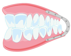 Image showing Denture on white background is insulated