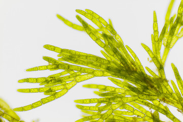 Image showing Microscopic view of green algae (Cladophora)