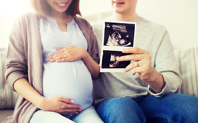 Image showing close up of couple with baby ultrasound images