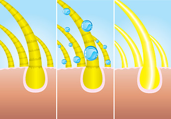 Image showing Illustration of three phase of hair cure