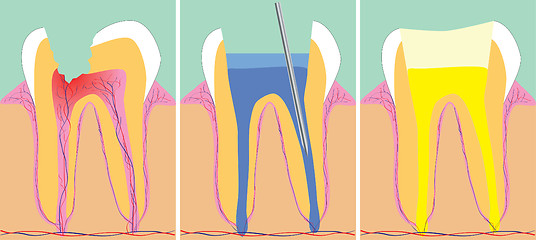 Image showing Three phase of dentistry