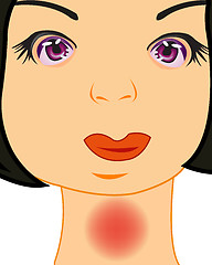 Image showing Vector illustration of the girl with pain in throat