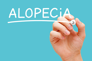 Image showing Alopecia Hair Loss Or Baldness Concept