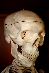 Image showing Human scull