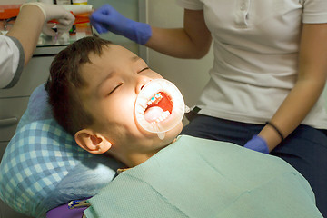 Image showing Orthodontist examining boy mouth