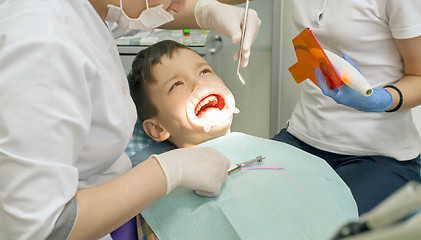 Image showing Orthodontist examining boy mouth