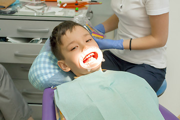 Image showing Orthodontist examining boy mouth