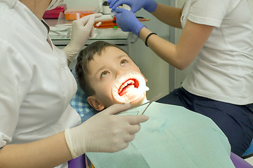 Image showing Orthodontist examining boy mouth