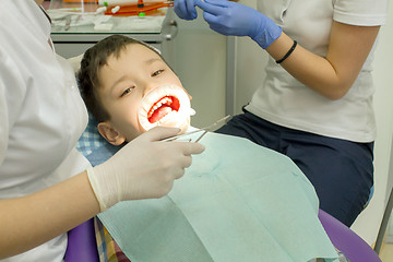 Image showing Orthodontist examining boy mouth