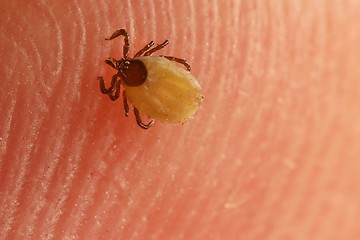 Image showing Tick on skin