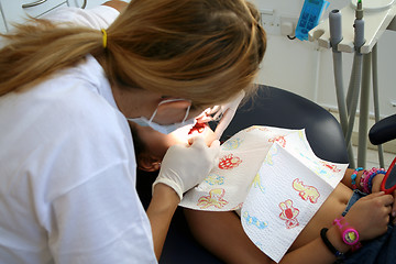 Image showing Dentist at work