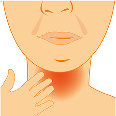 Image showing Vector illustration of the person with sick throat