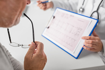 Image showing senior man and doctor with cardiogram at hospital