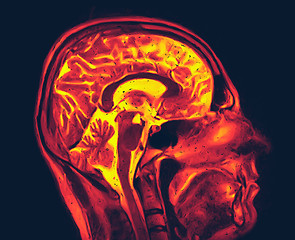 Image showing Magnetic resonance imaging of the brain. MRI scan vector