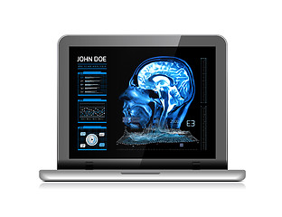 Image showing Notebook monitor with medical MRI and other real-time analyzes. Medicine of the future. Vector illustration on white