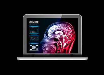 Image showing Notebook monitor with medical MRI and other real-time analyzes. Medicine of the future. Vector illustration on black