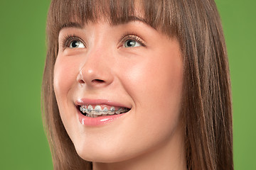 Image showing Beautiful young woman with teeth braces