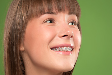 Image showing Beautiful young woman with teeth braces