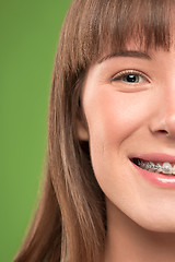 Image showing Beautiful young woman with teeth braces