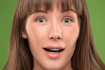 Image showing Beautiful young woman with teeth braces