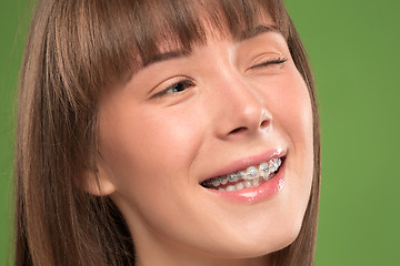 Image showing Beautiful young woman with teeth braces