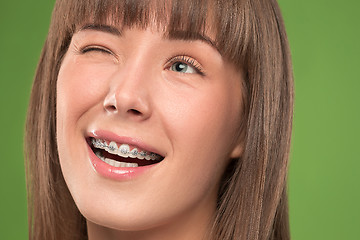 Image showing Beautiful young woman with teeth braces