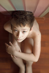 Image showing Boy with chickenpox