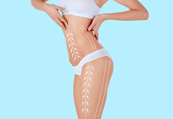 Image showing The cellulite removal plan. White markings on young woman body