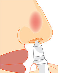 Image showing Vector illustration of the sick nose and medicine