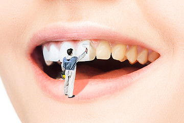 Image showing woman teeth before and after whitening. Over white background