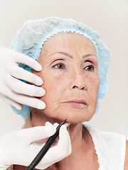 Image showing surgeon doing skin check on mid age woman before plastic surgery