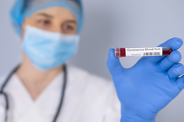 Image showing Nurse holding test tube with Positive Coronavirus test blood sam