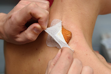 Image showing Replacing a medical bandage on a postoperative wound on the girl\'s neck