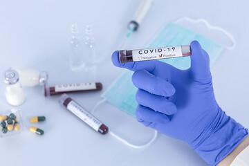 Image showing Analyst hand holding COVID 19 Coronavirus test blood