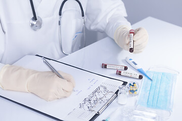 Image showing Doctor hands holding COVID 19 Coronavirus test blood making stat