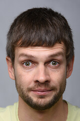 Image showing Close-up portrait of a man with bulging eyes of European appearance