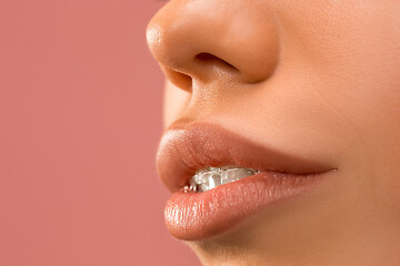 Image showing Beautiful young woman with teeth braces